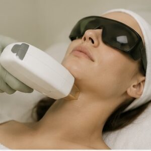 Chin Laser Hair Removal