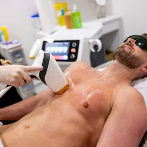 6 Session Laser Hair Removal Package