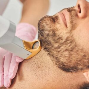 Beard Line & Cheeks Laser Hair Removal