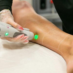 Lower Leg & Feet Laser Hair Removal