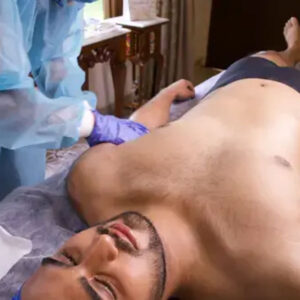 Full Arms & Hands Laser Hair Removal