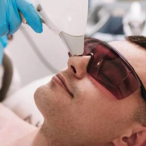 Nose Laser Hair Removal