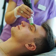 Unibrow Laser Hair Removal