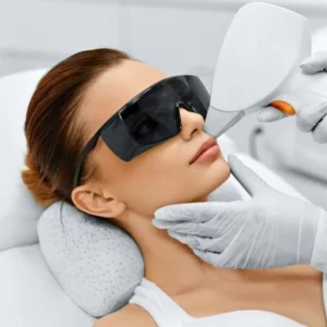 Upper Lip Laser Hair Removal