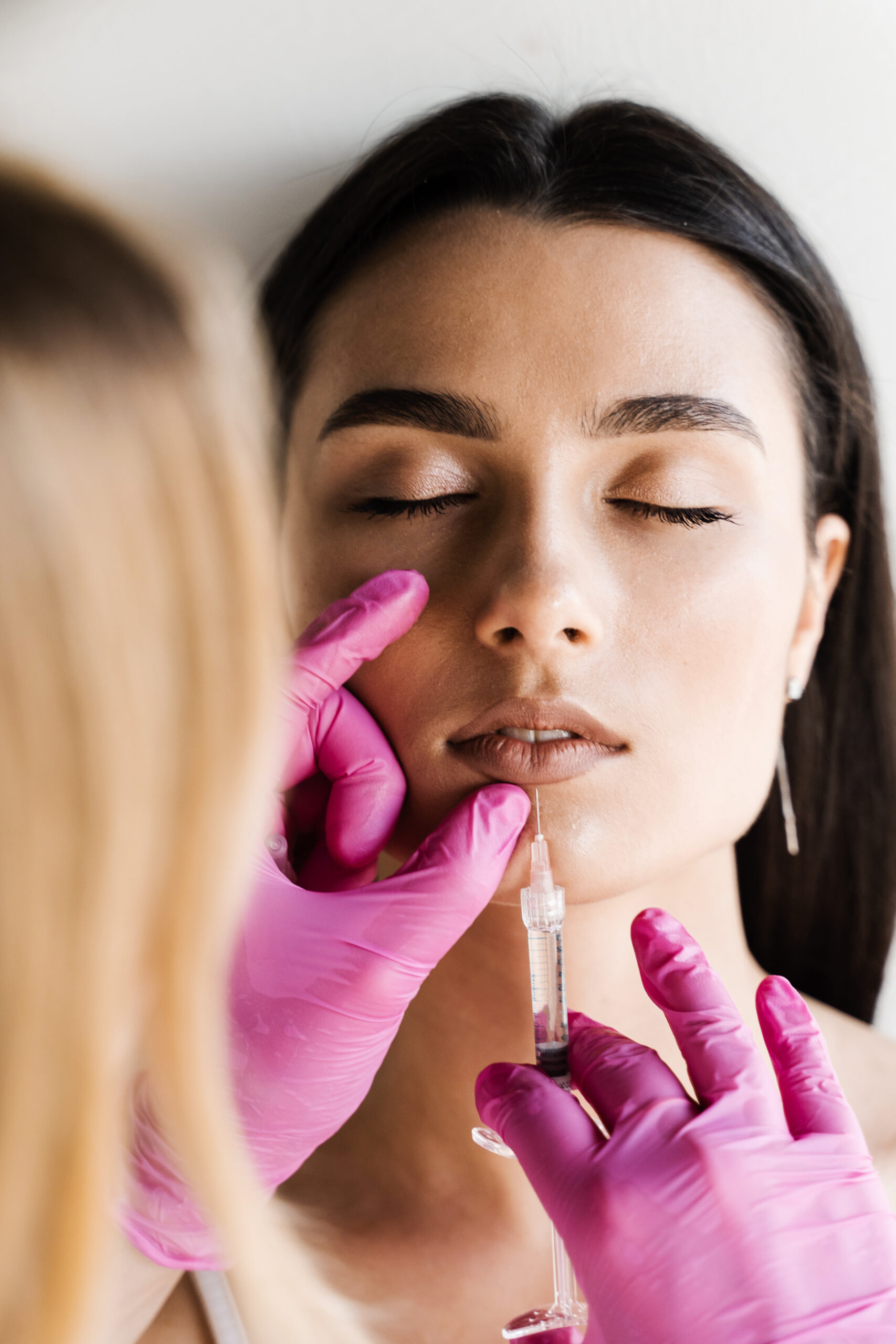 Dermal filler treatment at Lium Laser & Med Spa in Sugar Land, TX