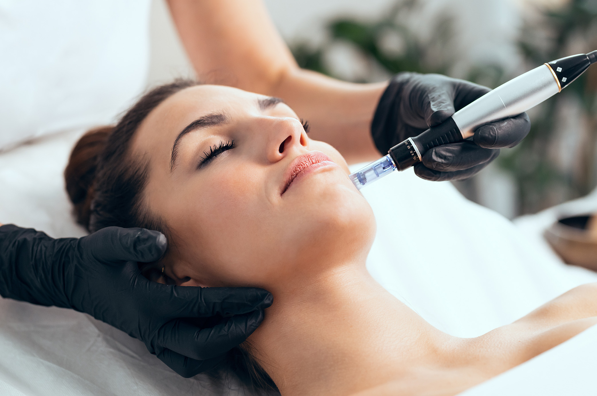 PRP rejuvenation treatment at Lium Laser & Med Spa in Sugar Land, TX