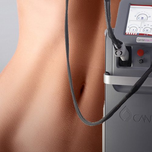 Laser hair removal treatment at Lium Laser Studio in Sugar Land, TX